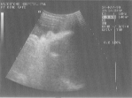 Week 37, scan 2  (side of face; nose & ear)